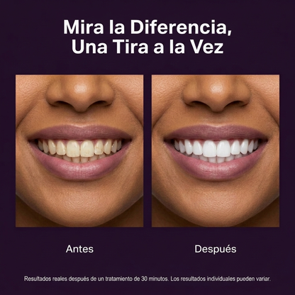 Purple Whitening Strips V34